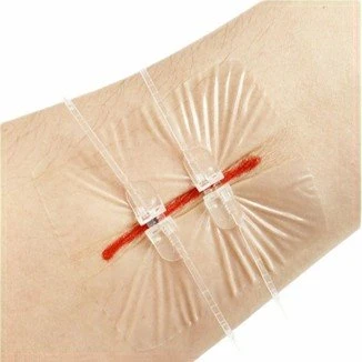 Skin Stapler Adhesive Pads factory